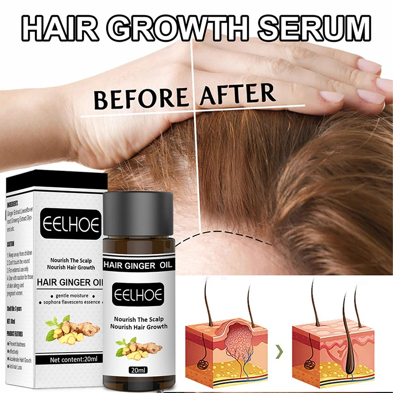 Three Scouts Ginger Hair Growth Essential Oil Serum Hair Treatment Anti Lost Beauty Hair Care