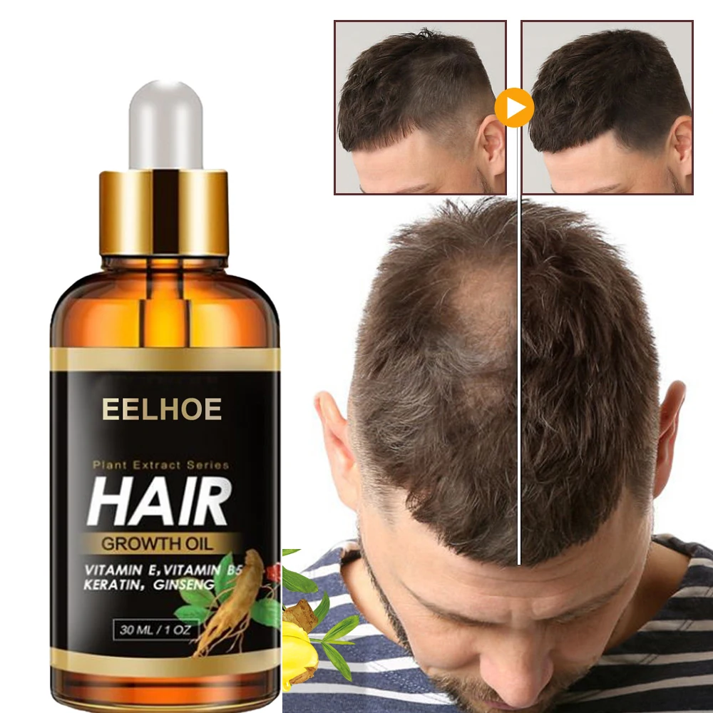 

Hair Growth Products Natural Organic Treatment for Bald Hair Serum Anti Hair Loss Scalp Treatments Boosting Hair Growth Oil