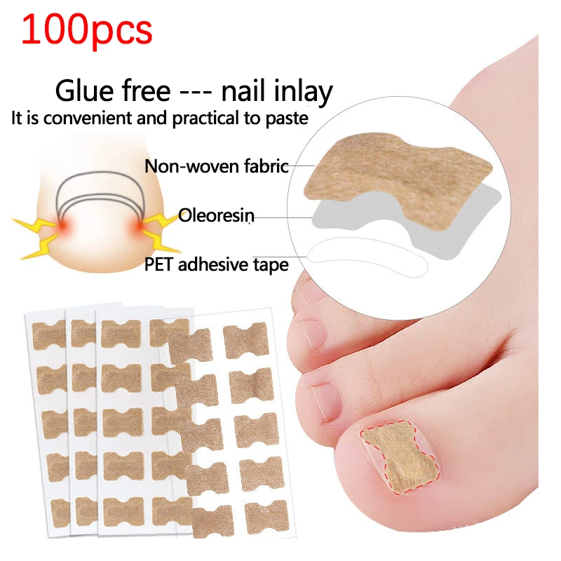 

100 шт. корректирующая наклейка для ногтей полоска для ногтей антирулон клей для ногтей инкрустация ногтей Корректор ногтей Наклейка для коррекции ногтей