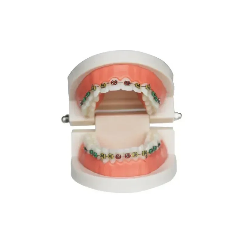 

Dental Orthodontic Tooth Model Cermet Contrasting Brackets Communication Dentist Demo Studying Tooth Crown Standard Implants New