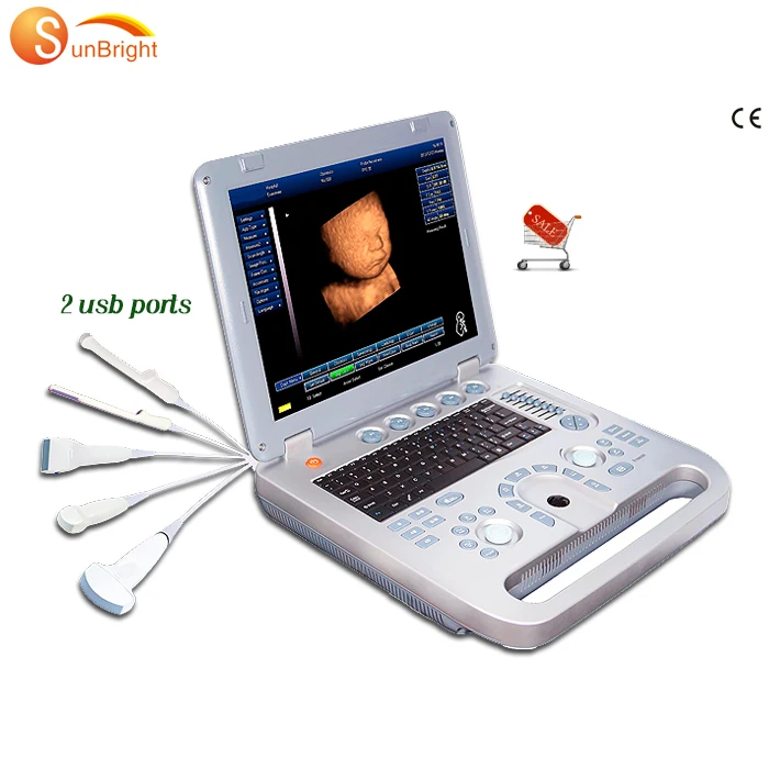

Sunbright cheap laptop 3d color doppler system portable ultrasound machine echo doppler Sun-800D