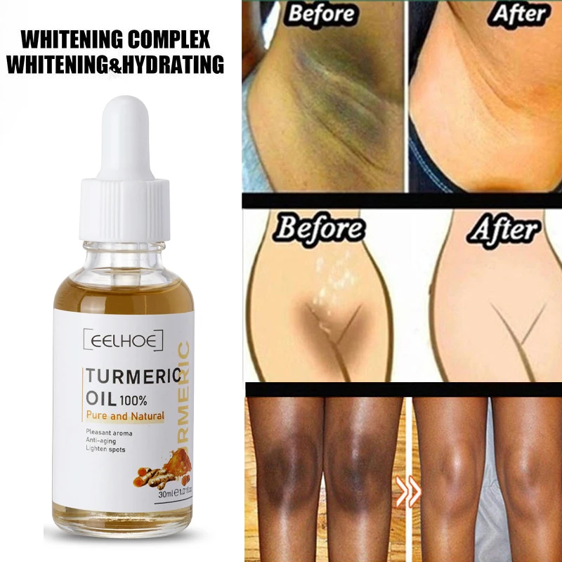 

Turmeric Oil Skin Glow Serum Improve Pigmentation Lightening Acne Dark Patches Bright Skin Dark Spot Corrector Whitening Serum