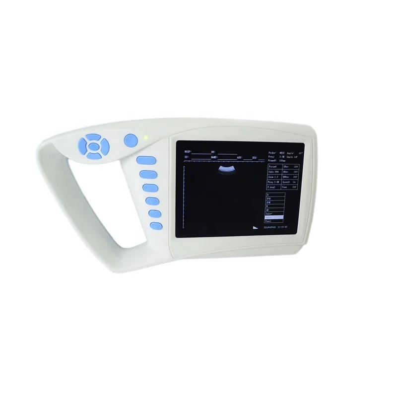 

Easy Carried 7inch LCD Handheld Diagnostic Ultrasound Machine Cost in Clinic