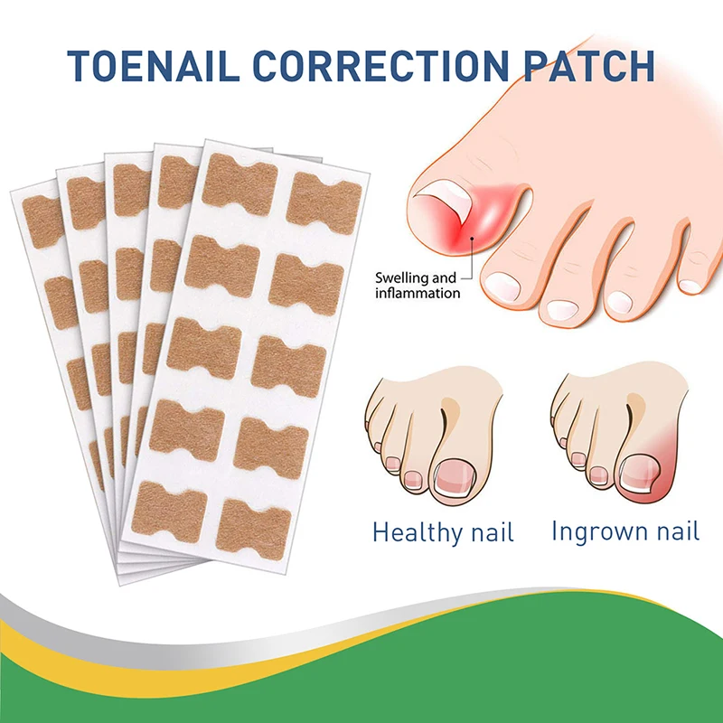 

50Pcs Nail Correction Stickers Ingrown Toenail Corrector Patches Paronychia Treatment Recover Corrector Pedicure Tools