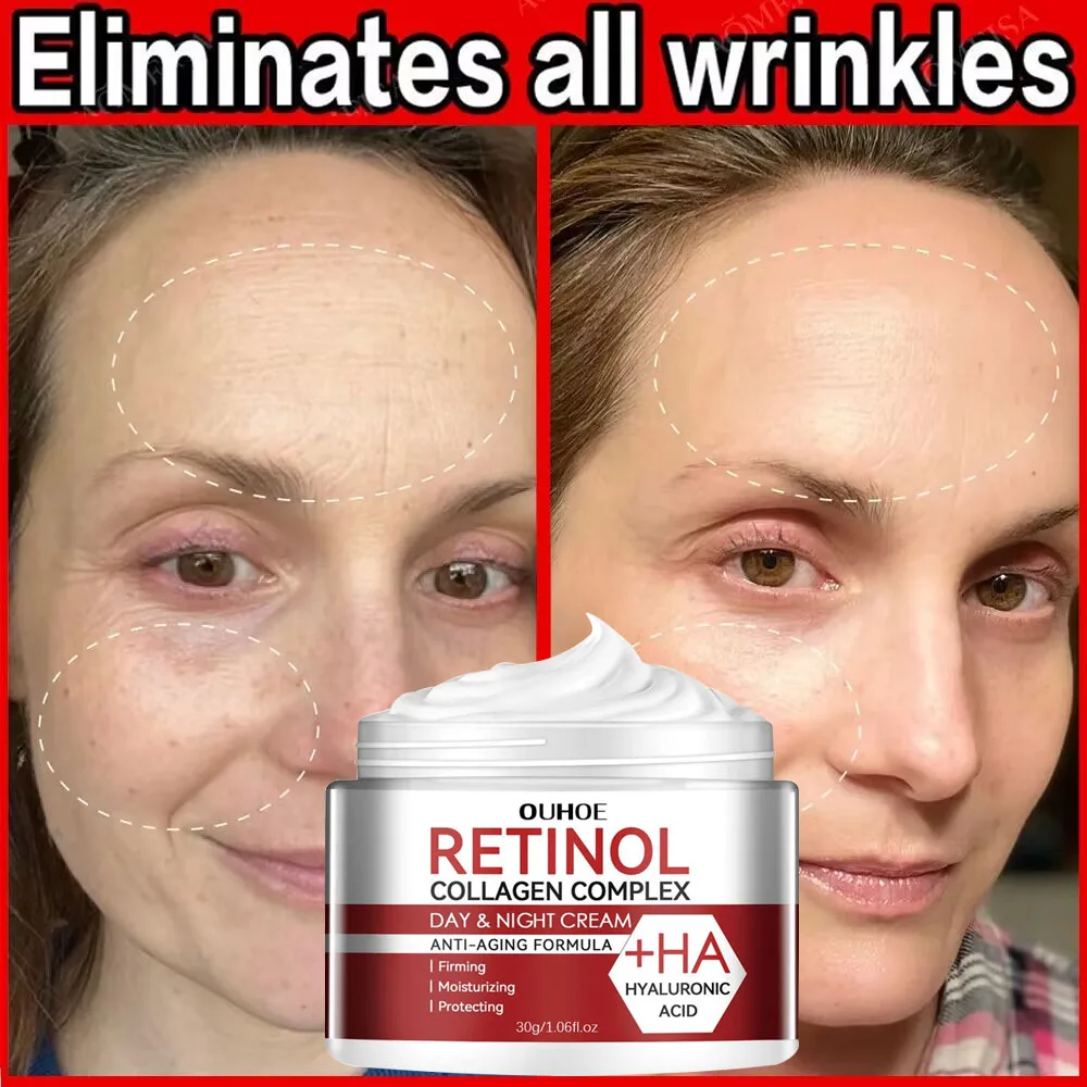Retinol Wrinkles Remover Face Cream Firming Lifting Anti Aging Fade Fine Lines Whitening Moisturizer Skin Care Korean Cosmetics