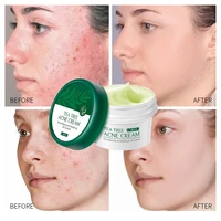 effective acne removal cream tea tree anti acne oil control shrink pores whitening moisturizing soothing facial gel skin care