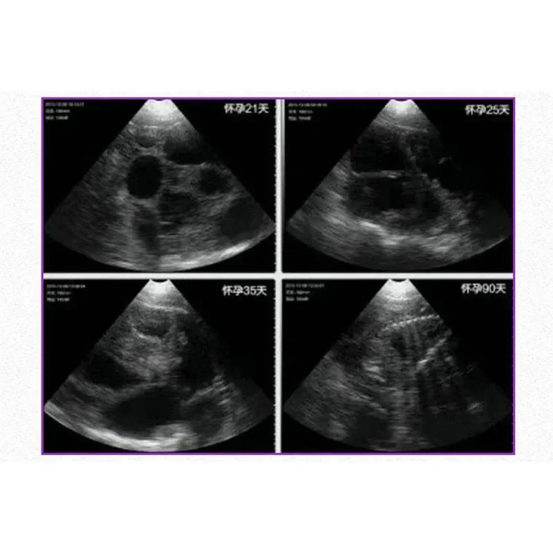 Акция Android IOS Windows System Беспроводной ультразвуковой сканер с выпуклым массивом