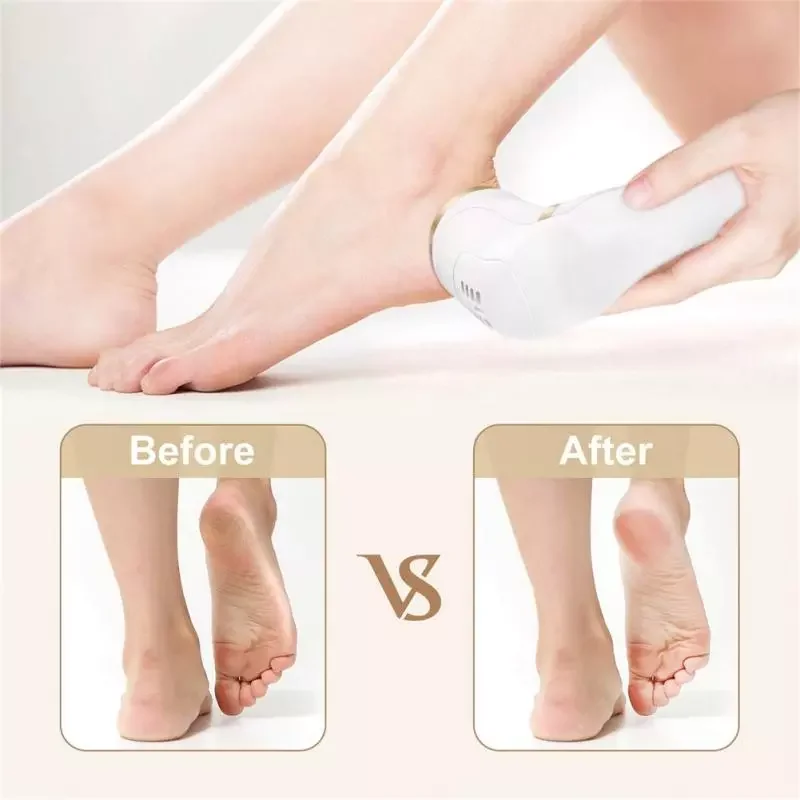 

NEW2023 IPX7 Foot File Remover With 3 Portable Roller Heads Waterproof Remove Calluses Cracked Dead Skin Foot Health Care Tools