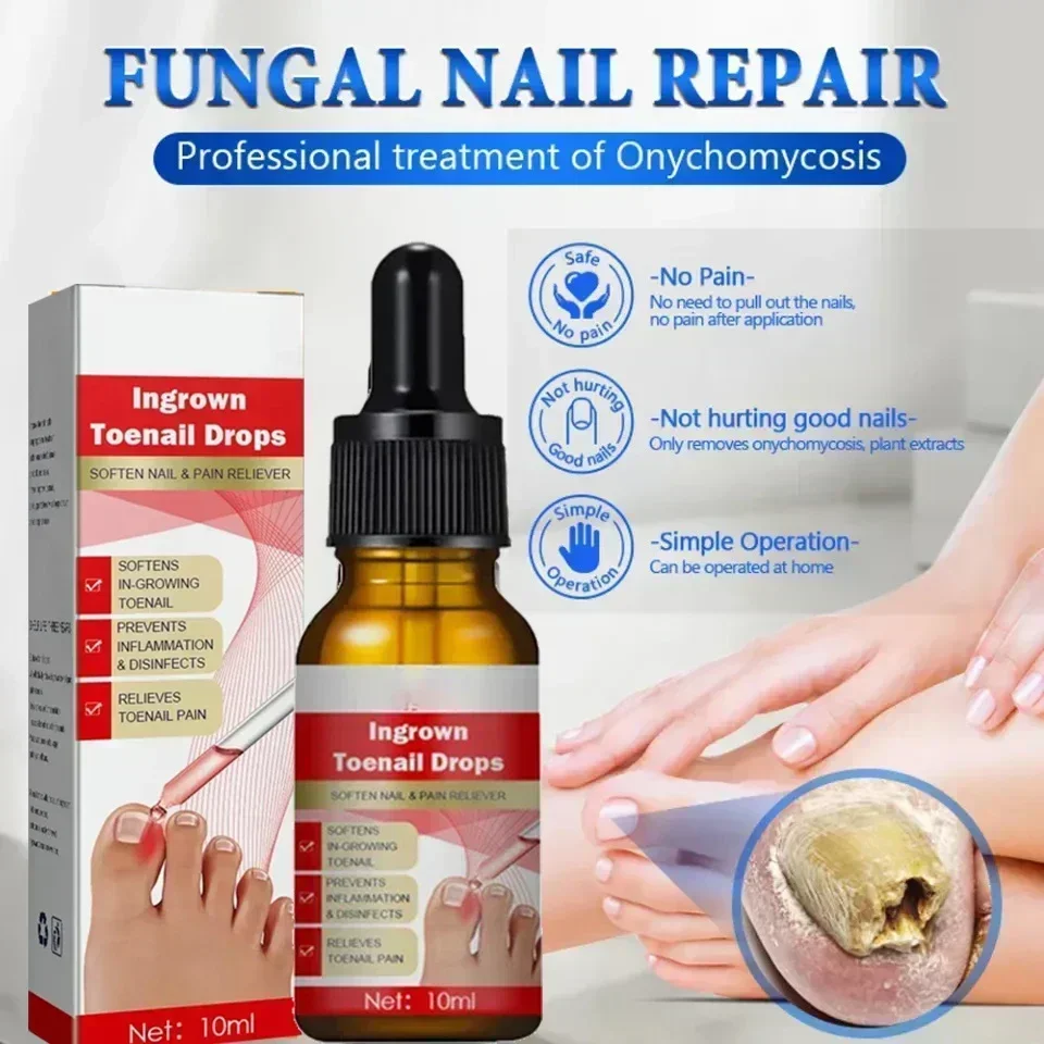 Масло от грибка ногтей удаление на ногах ремонт онихомика антиинфекционный гель
