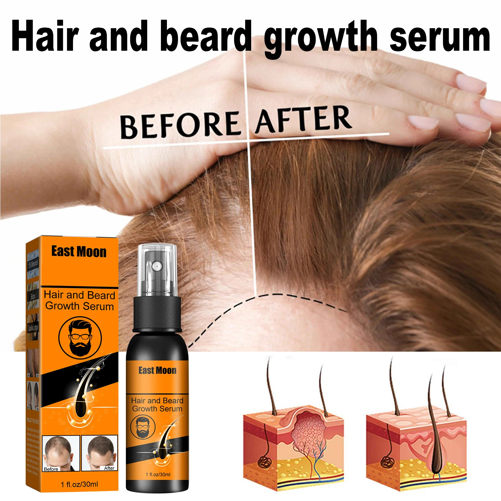 

Ginger Hair Growth Spray Beard Grow Products Anti Hair Loss Serum Fast Growing Nourish Soften Scalp Repair Damaged Hair Care