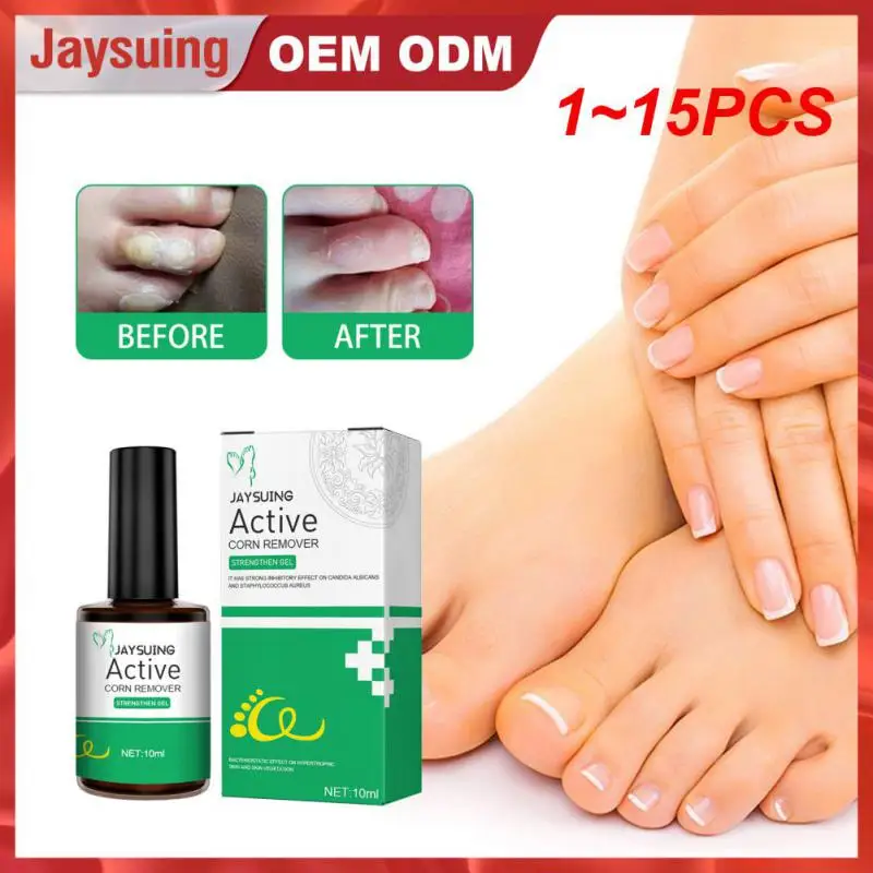 

1~15PCS 7Days Remove Foot Corn Cream Treat Fungal Remove Hand Callus Foot Care Antibacterial Gel 10ml