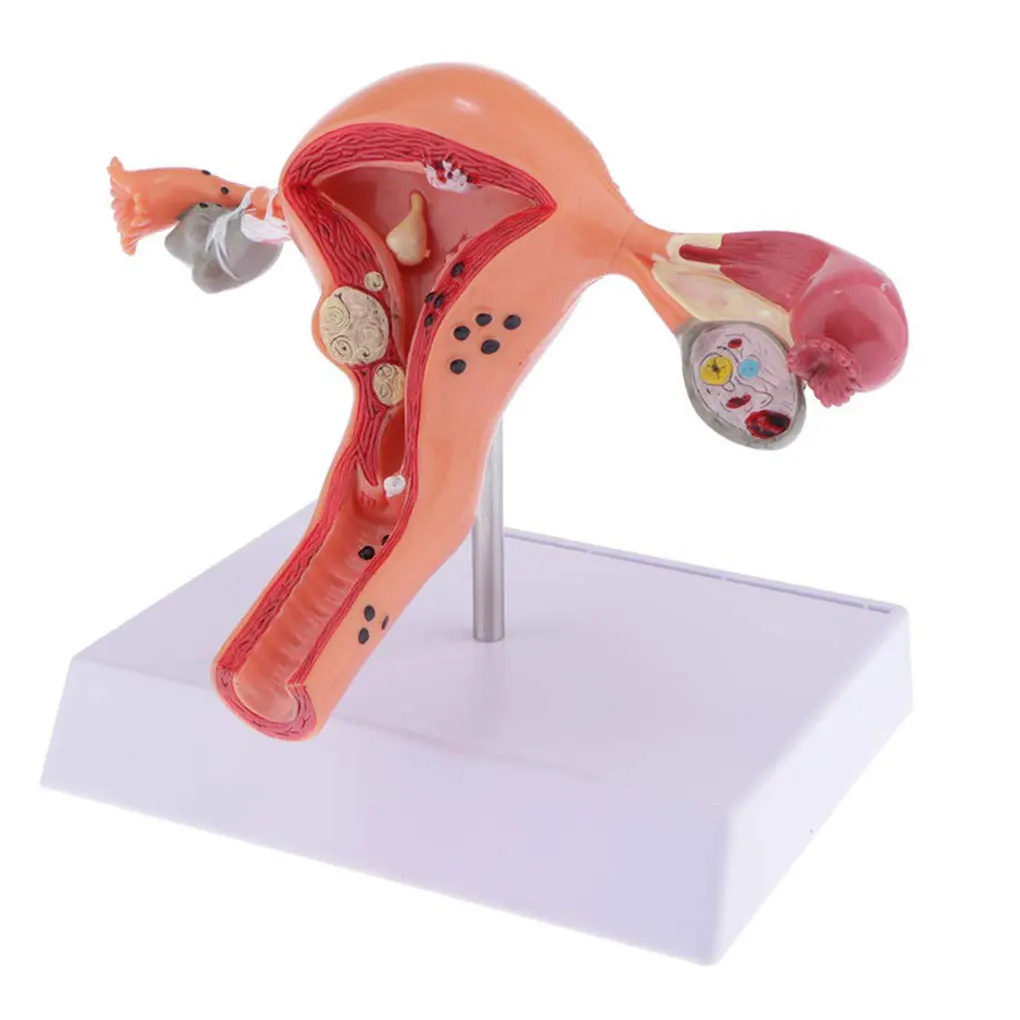 

Female Uterus Structure Plastic Model Educational Experiment Laboratory