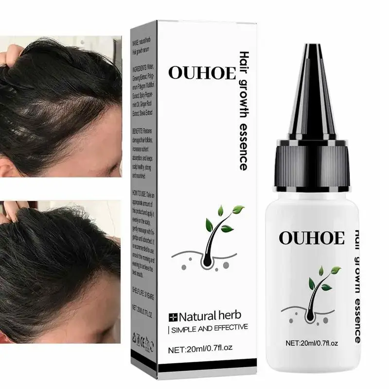 

Hair Growth Oil 20ml/0.7fl.oz Hair Growth Oil For Thinning Hair Strengthen Care Nourishing Hair Care Essence Conditioner Prevent