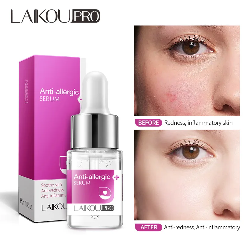 

Anti-Allergic Serum Moisturizing Nourish Repair Sooth Skin Removes Redness Anti-Inflammatory Essence Oil Face Skin Care Product