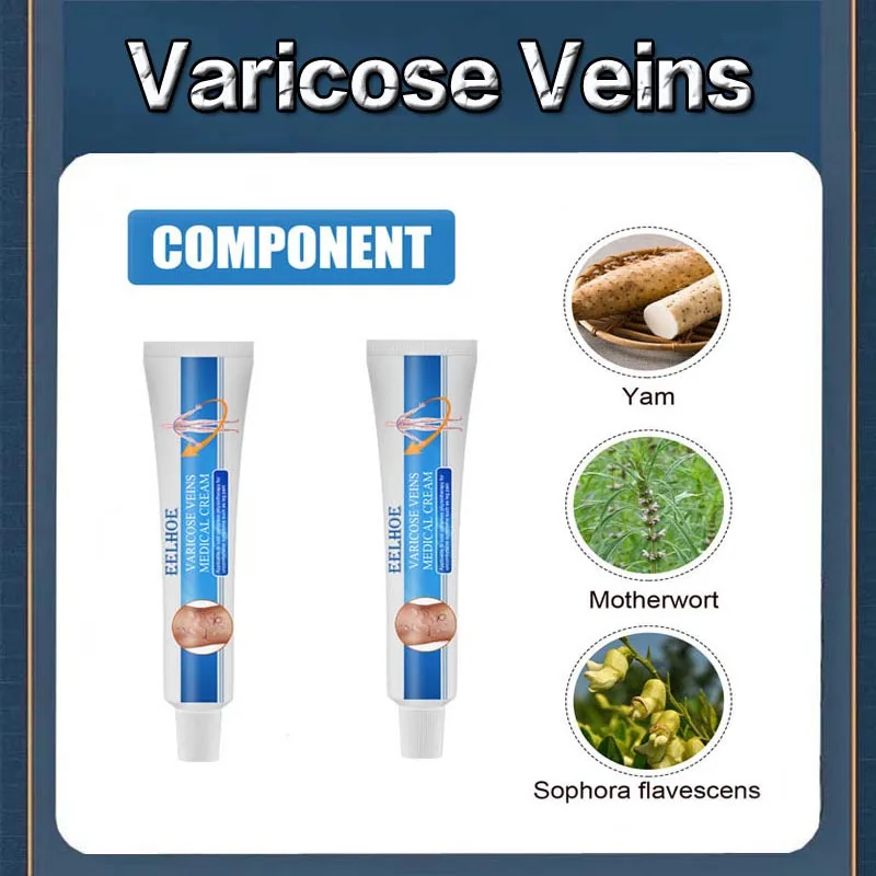 

ointment for varicose veins Effective varicose vein relief cream to relieve vasculitis phlebitis spider pain treatment