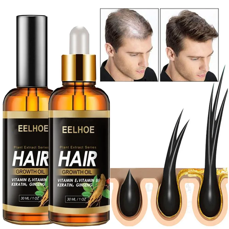 

Эфирное масло для роста волос продукты, спрей против выпадения волос, сыворотка для ухода за имбирем, сухие и волнистые поврежденные тонкие ...