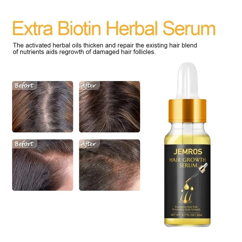 

Ginger Hair Growth Essential Oil Serum Anti Hair Loss Products Fast Grow Prevent Hair Thinning Dry Frizzy Damaged Hair Care 20ml