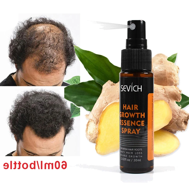 

Hair Growth Spray Anti Hair Loss Essential Fast Regrowth Prevent Hair Damaged Thinning Repair Care Scalp Treatment Ginger juice