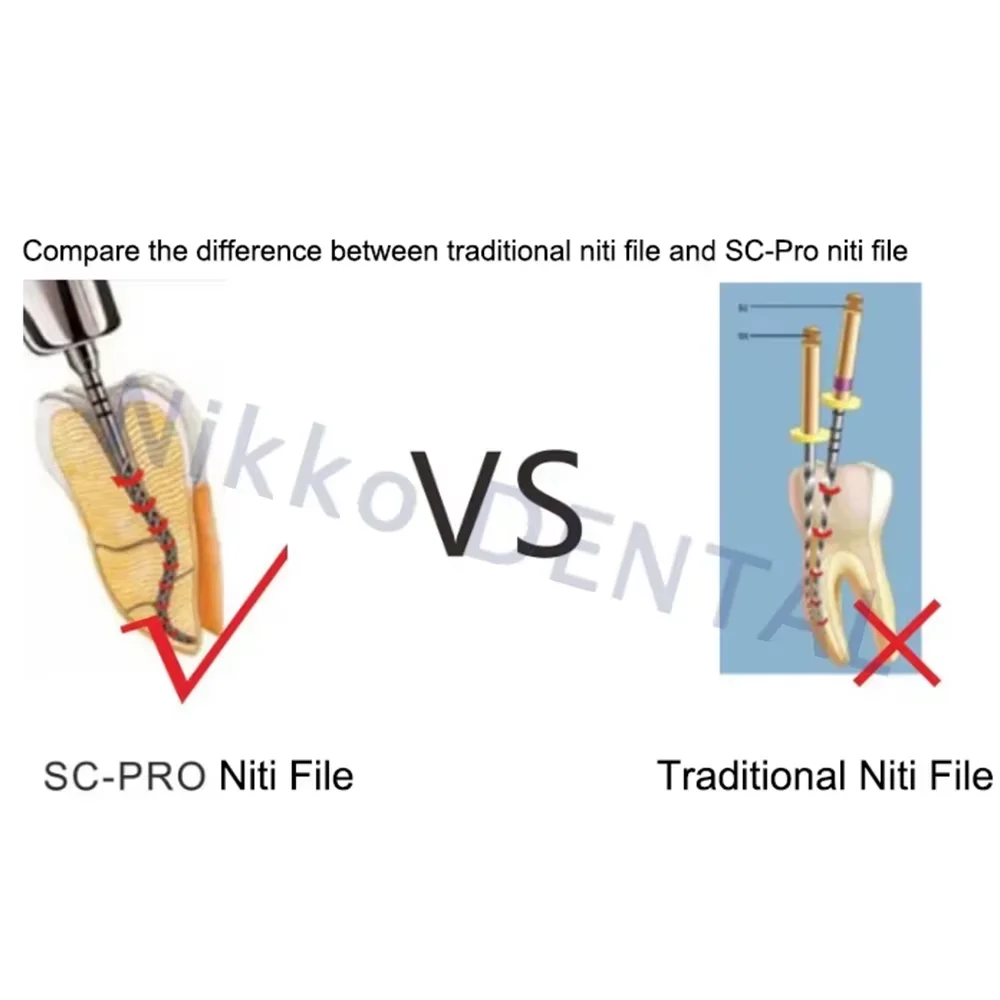 COXO 10/5 шт. стоматологические файлы нитинол роторный универсальный двигатель