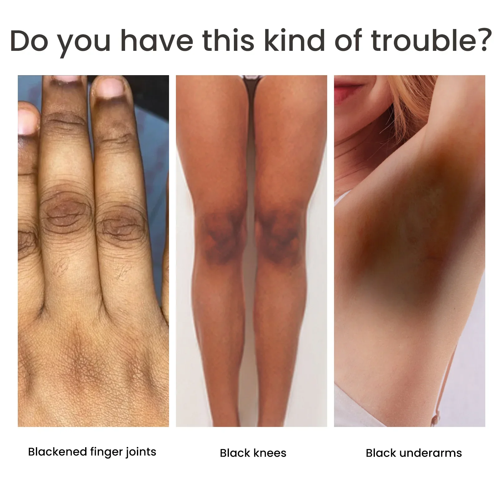 Отбеливающий крем Sdotter для суставов тела подмышек ног коленей локтей Осветляющий