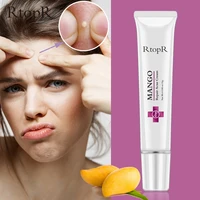 mango repair acne cream anti acne spots acne treatment scar blackhead cream shrink pores whitening moisturizing face skin care