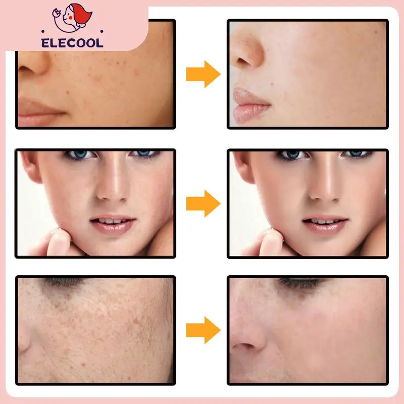 

Whitening Anti-freckle Cream Brighten Skin Tone And Lighten Spots Moisturizing Moisturizing Cream Skin Care Products TSLM1