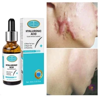 acne scars removal oil treatment surgical scarsburnsstretch marksrepairsmoothing skin cream whitening moisturizing body care