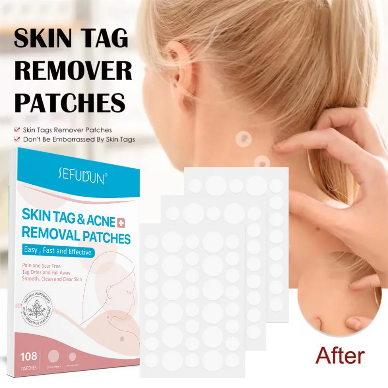 

108pcs/Box Skin Tag Remover Patch Warts Pimple Treatments Cream Papillomas Flat Warts Anti-infection Foot Corn Relief Skin Care
