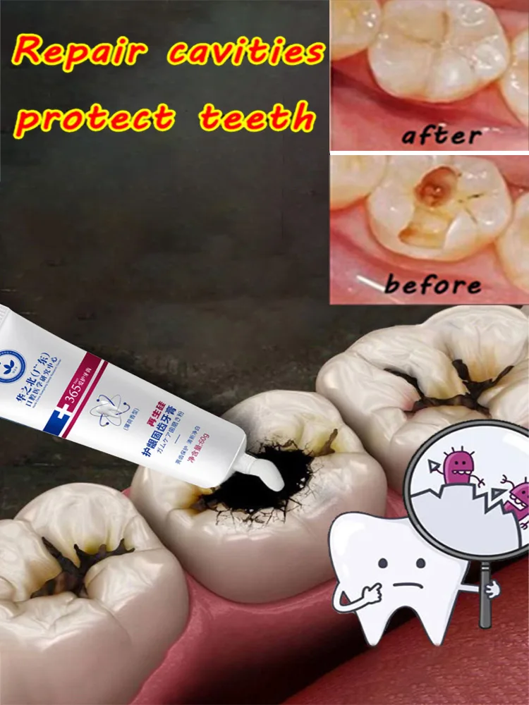 

New Upgrade Quick Repair of Cavities Caries Removal of Plaque Stains Decay Whitening Yellowing Repair Teeth Teeth Whitening