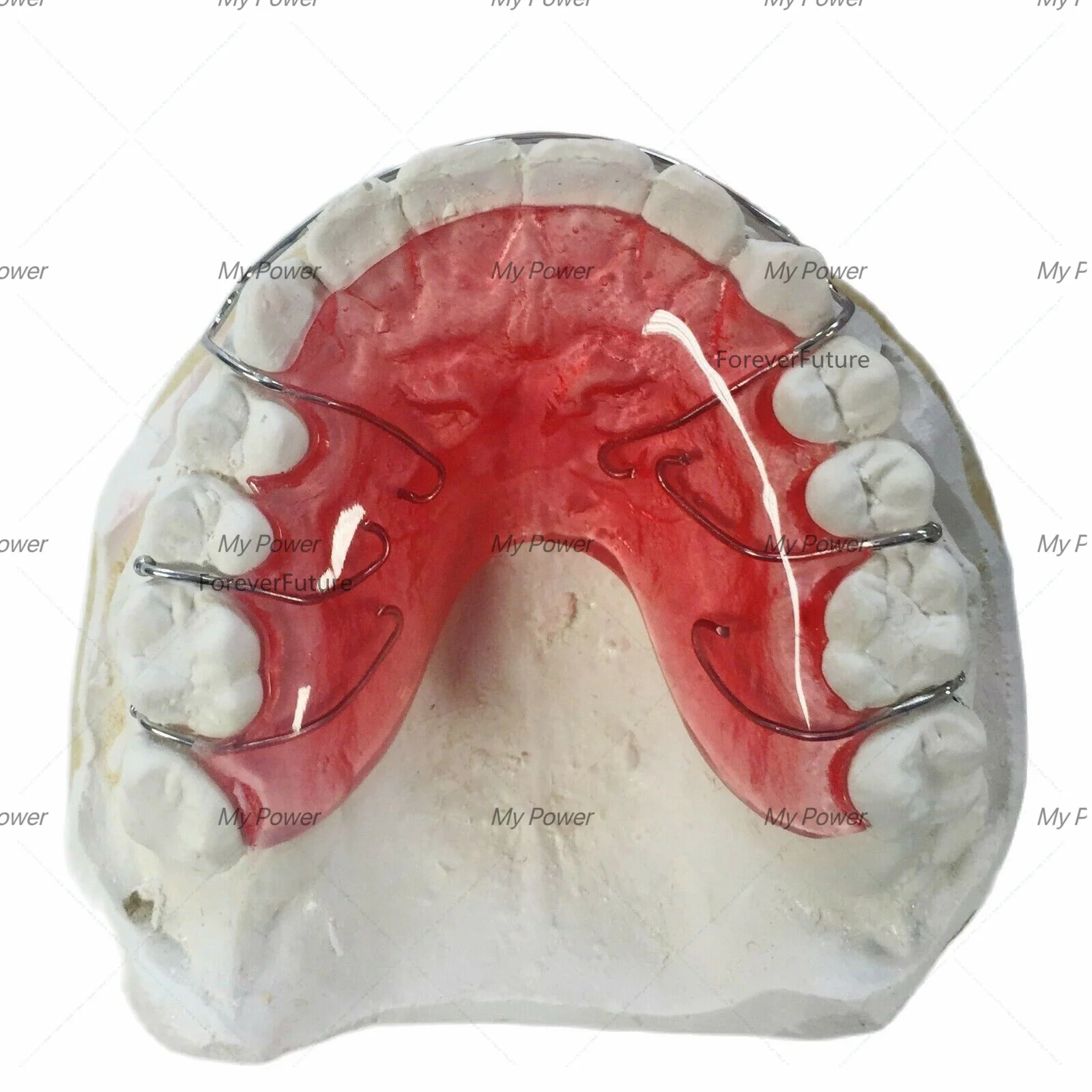 20 шт. стоматологические фиксаторы для зубов 0 7/0 8/0 9