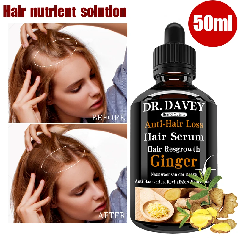 

Ginger hair growth products natural anti-hair loss and anti-baldness treatment fast growth nourishing dry damaged hair care