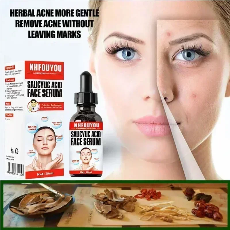 Эффективный крем для удаления акне лечение шрамов сужение пор контроль жирности