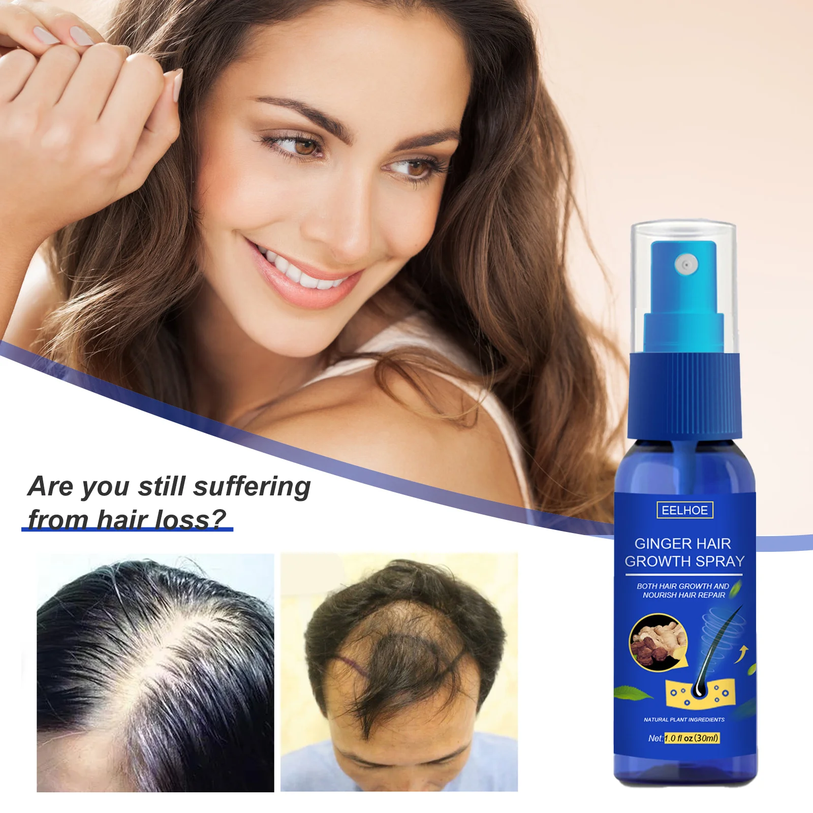 

Hair Growth Spray Fast Grow Hair Loss Preventing Hair Loss Care Dense Beauty Hair Growth Spray For Man Cosmetics