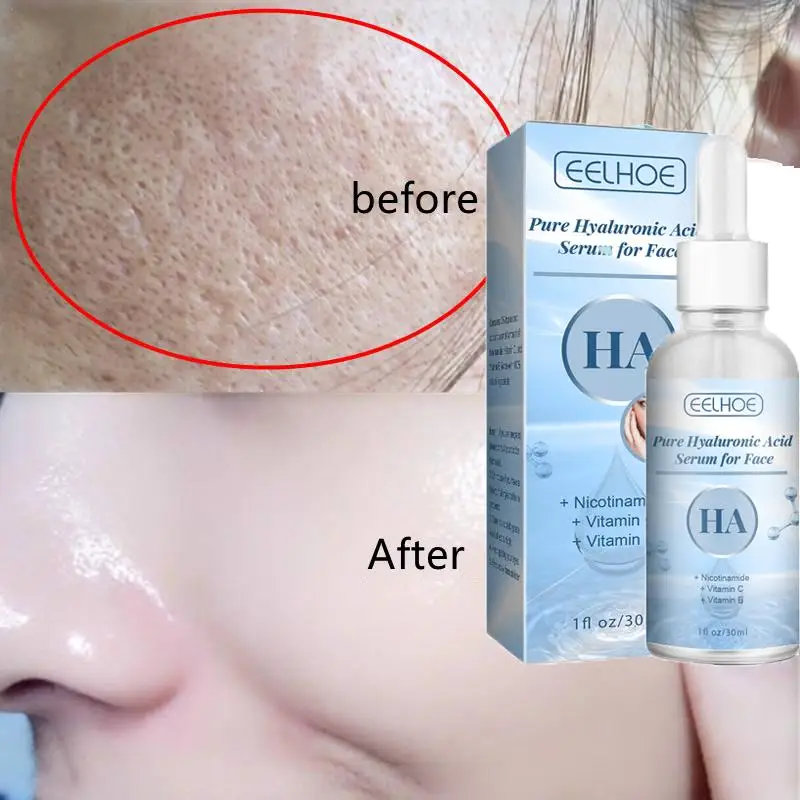 

30ml Hyaluronic Acid Shrink Pore Moisturizing Face Serum Niacinamide Whitening Brighten Anti-wrinkle Dark Spot Remover Skin Care