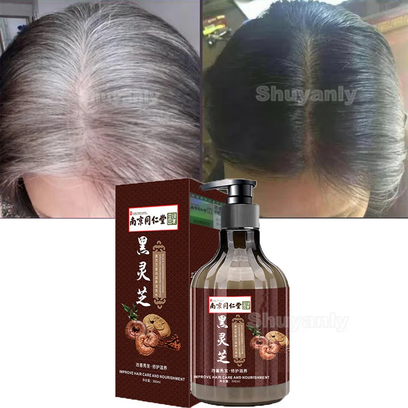 Ant Shampoo Treatment