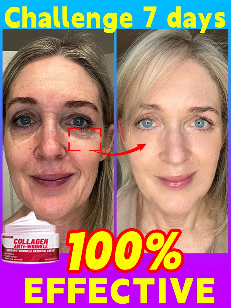 

Effective anti-ageing and anti-wrinkle facial serum to remove facial wrinkles fine lines around the eyes crow's feet neck wrinkl