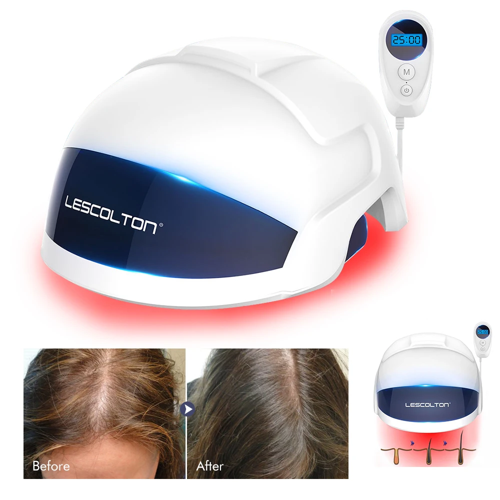 Lescolton Men Hair growth Cap helmet Laser Hair regrowth laser LED helmet 650nm Hair loss laser treatment LLLT hair fast growth