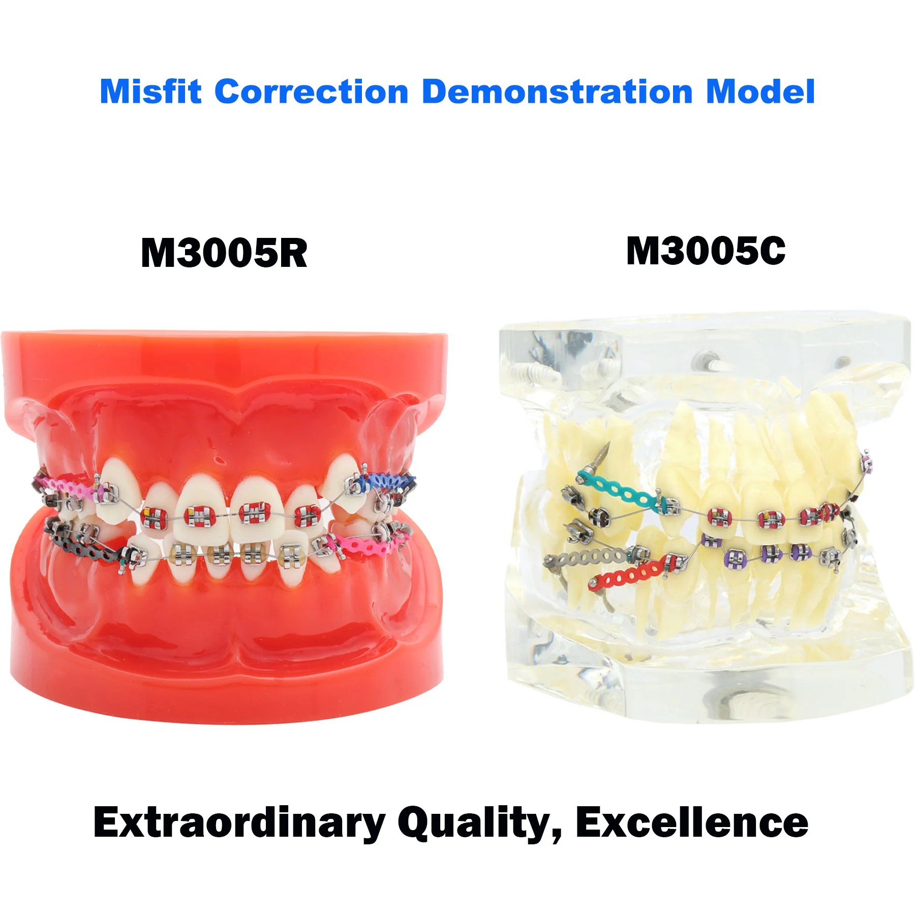 

Dental Model Orthodontic Teeth Model With Metal/ Ceramic Brackets For Orthodontic Teaching Restoration Practice