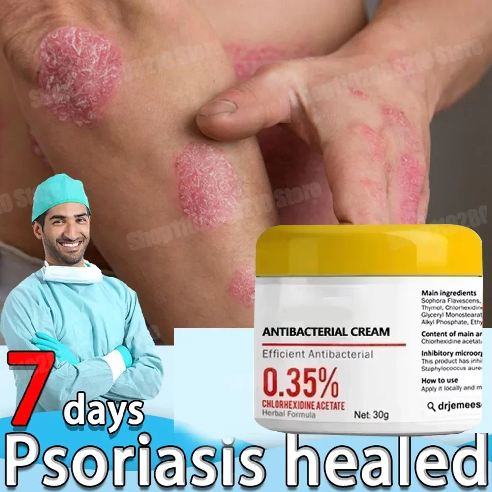 Natural Psoriasi Eczma Cream Works Really Well For Dermatitis Psoriasis Eczema Urticaria Beriberi
