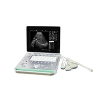 amazon best selling ultrasound polyurethane probe covers probe ultrasound ultrasound probe cover