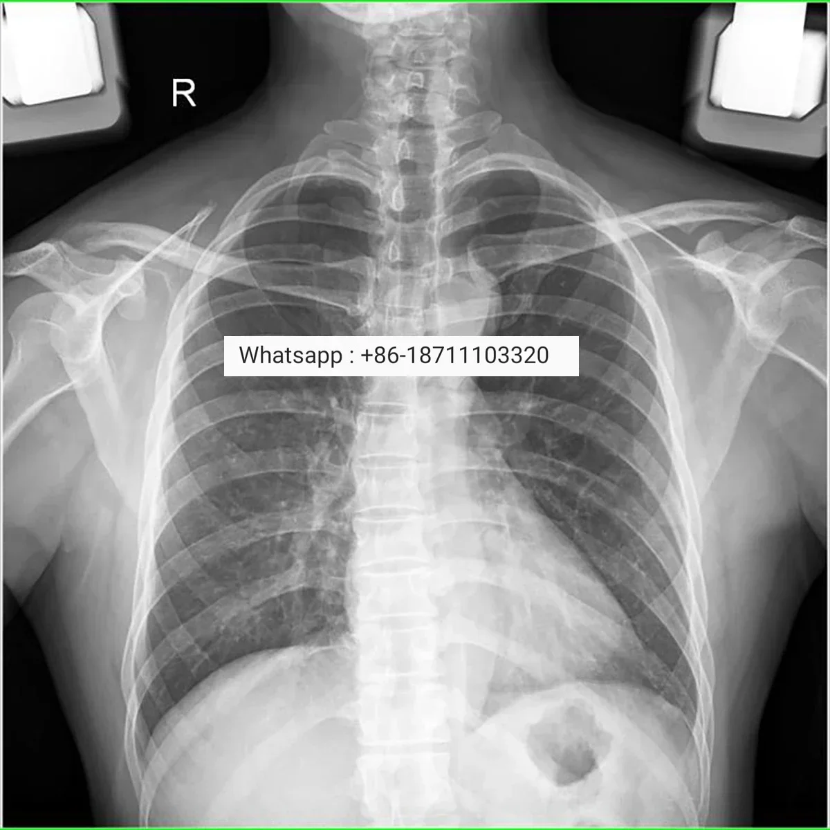 Рисунок 4 - Медицинское радиологическое оборудование