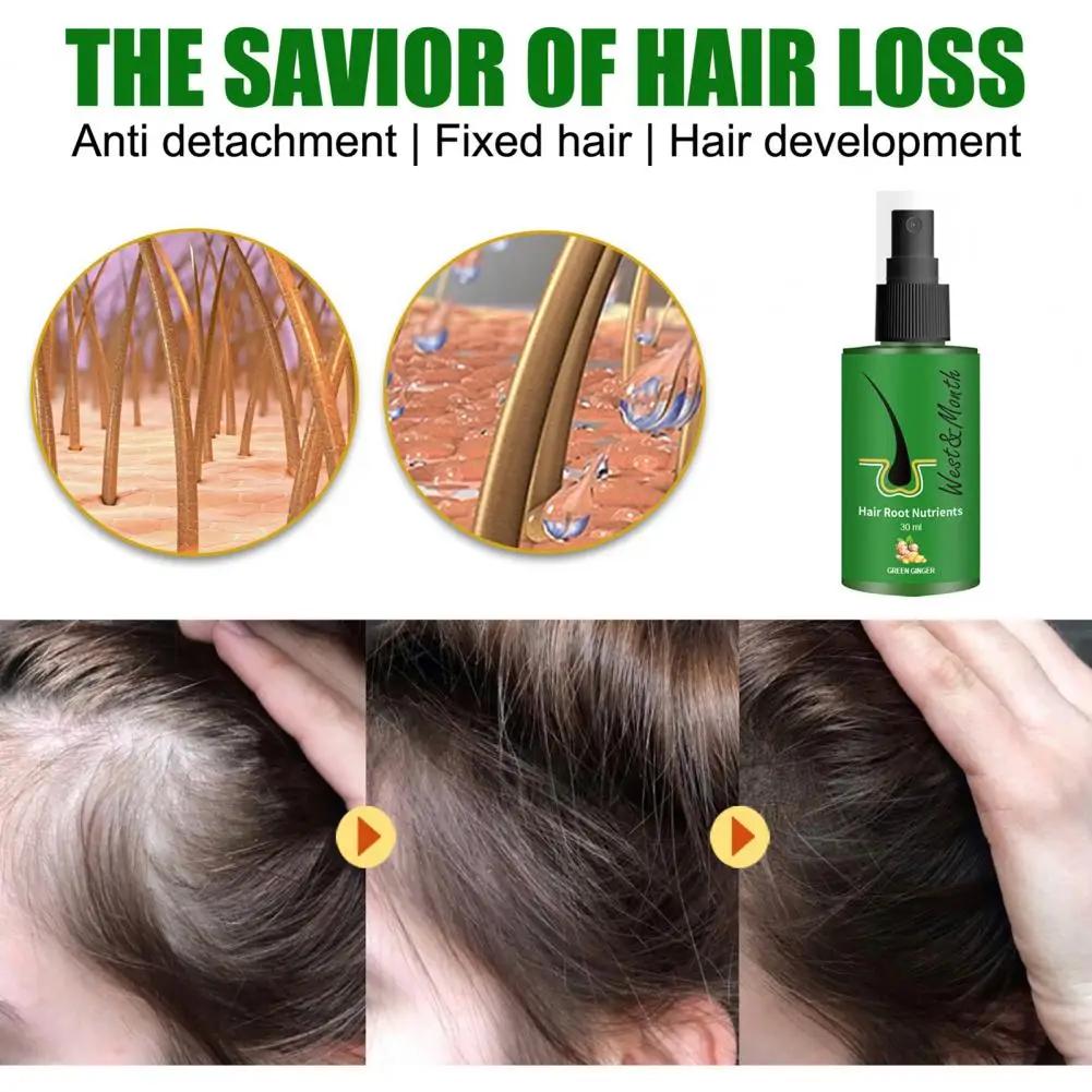 

30ml Hair Growth Serum Hair Maintain Effective Non-oily Ginger Hair Growth Care Treatment Oil for Women