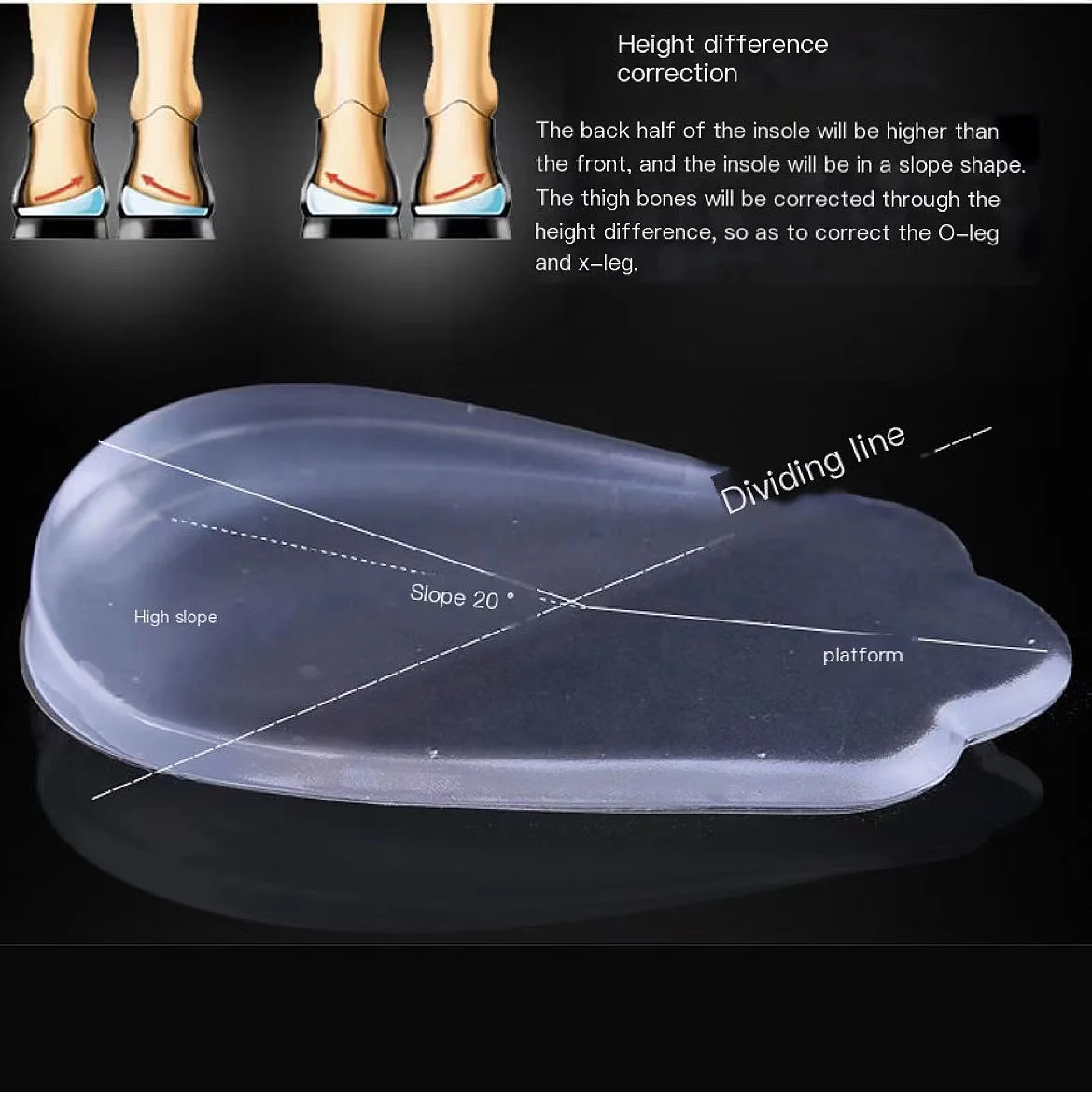 X/ O-shaped Leg Correction Insole Inside Eight Figure Outside Eight Straighten Healthy Beautiful Legs Correct Looped Legs images - 6