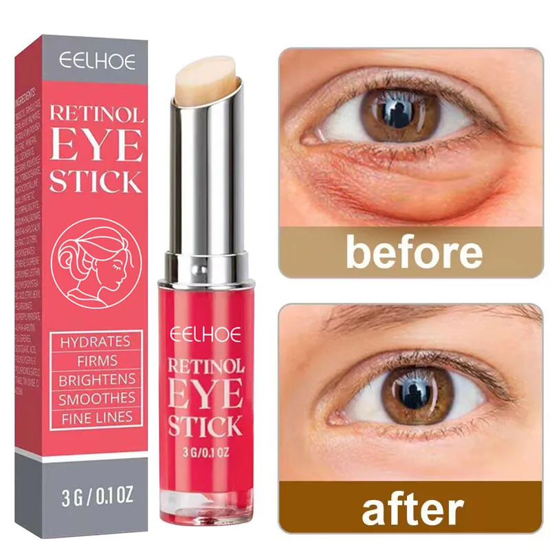 

Retinol Anti-Wrinkle Eye Cream Effect Fades Fine Lines Remove Puffiness Eye Bags Dark Circles Reduce Eye Fat Particles Skin Care