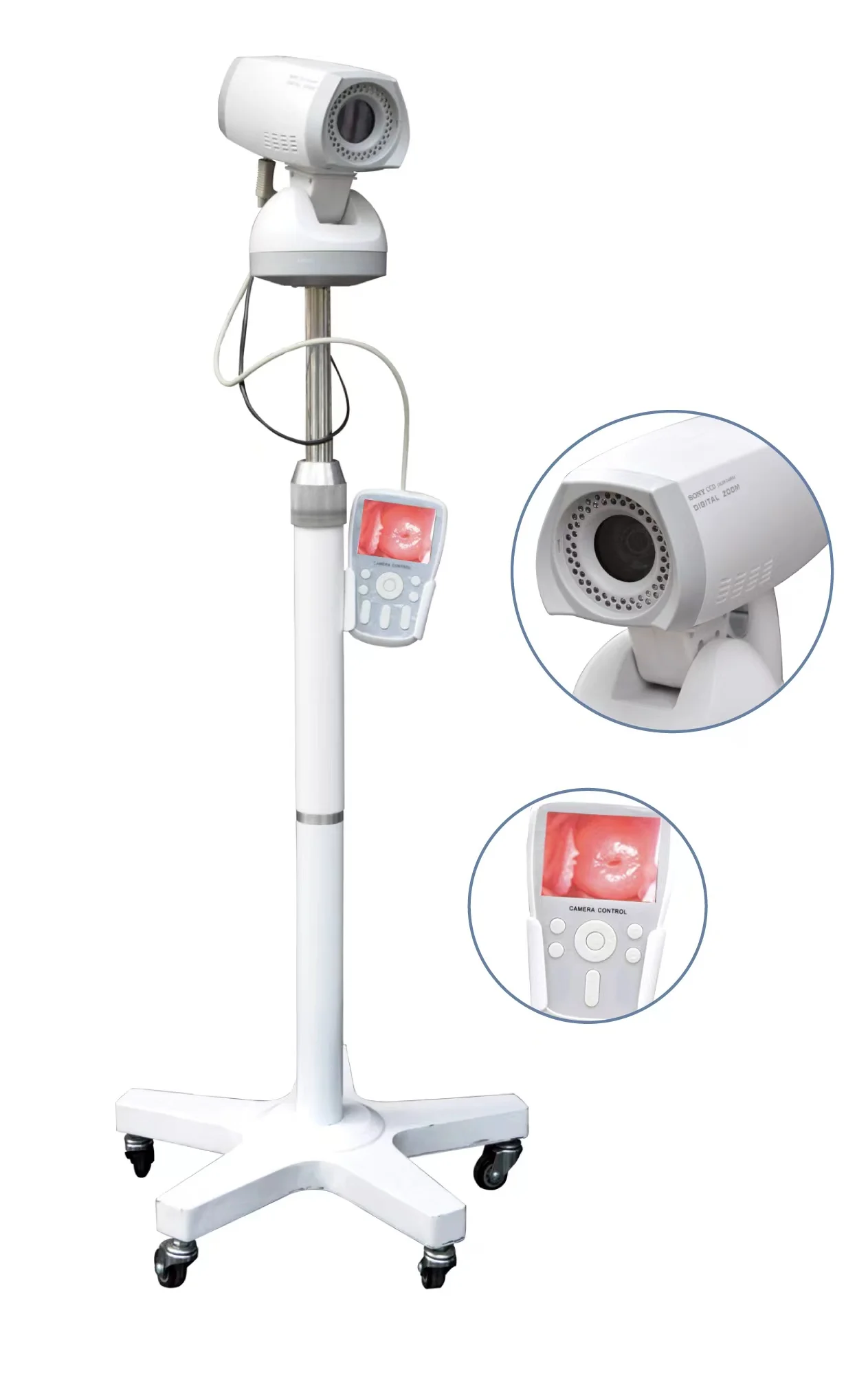 

colposcopy
