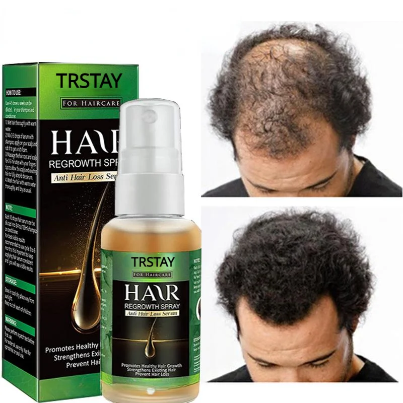 

Имбирь эфирное масло для роста волос для быстрого роста волос сыворотка-спрей предотвращает выпадение волос, лечение кожи головы, красота, здоровье, уход за волосами
