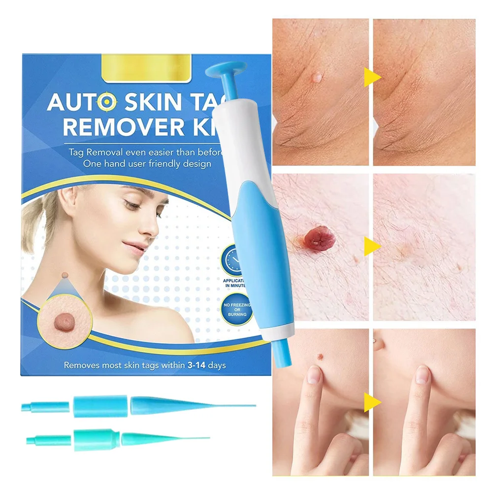 

Набор для удаления этикеток на кожу, устройство для удаления микро-этикеток на кожу, бытовое устройство для удаления родинок, инструмент для легкой чистки и ухода за кожей
