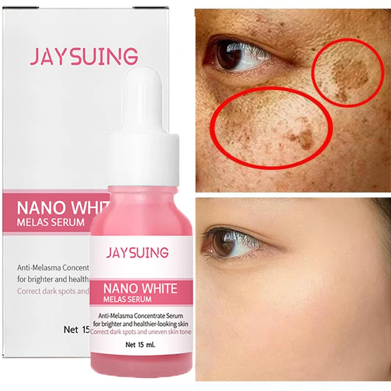 Whitening Freckles Serum Fade Dark Spots Removal Melanin Melasma Brighten Improve Dull Anti Aging Moisturizing Beauty Skin Care