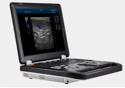 Рисунок 3 - Дешевый ноутбук, 3d-система Доплера,