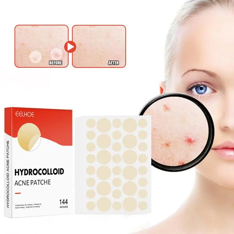 

Zit Patch 144pcs Invisible Pimple Spot Patches Hydrocolloid Acnes Spot Pimple Patches Effective Pimples Sticker For Healing